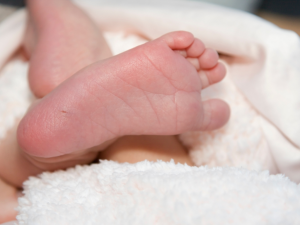 Un pie de un bebe para un diagnostico genético de Fenilcetonuria