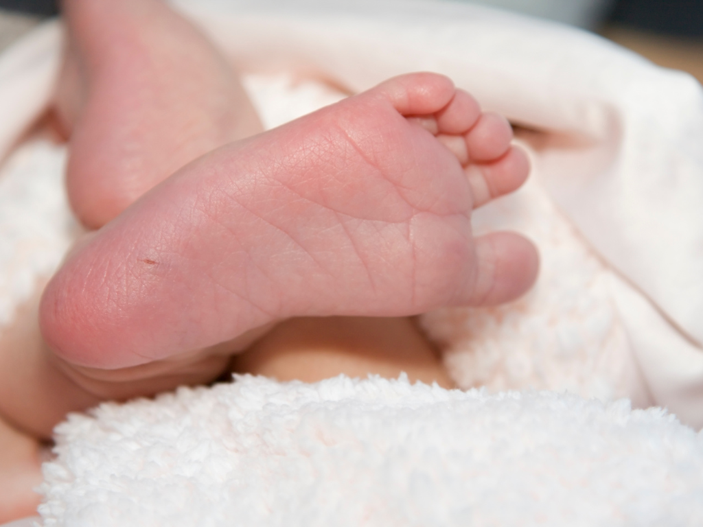 Un pie de un bebe para un diagnostico genético de Fenilcetonuria