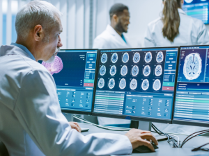 Persona analizando tumores cerebrales