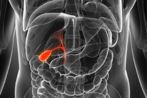 Imagen del cuerpo humano con foco en la bilis para ilustrar un texto sobre Colangiocarcinoma.